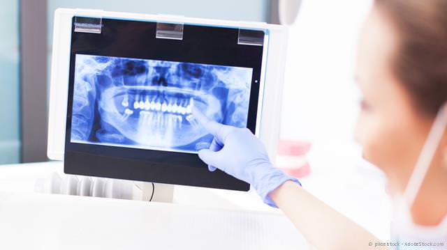 Diagnose der Parodontitis