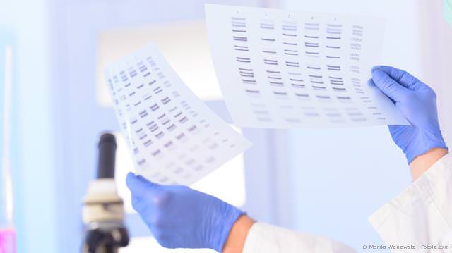 DNA-Test auf genetisches Parodontitis-Risiko